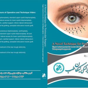 *(2025)*A Novel Technique for Periocular Surgery: Upper Lateral Access for *Lower Lid Blepharoplasty*- A Transcutaneous and Transpreseptal Approach. *Javier Beut, MD* *4 hours of operative and technique video!* ——————— *4 Cases With 4 Hours of Operative and Technique Video: Case 1: Secondary blepharoplasty, standard upper eyelid blepharoplasty, no fat removal, upper lateral access for lower eyelid blepharoplasty, transpreseptal approach, canthal support, inferior lateral retinaculum canthoplasty, periorbital fat grafting, preseptal orbicularis muscle graft. Case 2: Primary transcutaneous blepharoplasty, canthoplasty, periorbital fat grafting, standard upper eyelid blepharoplasty, fat and muscle removal, upper lateral access for lower eyelid blepharoplasty, transcutaneous approach, canthal support, inferior lateral retinaculum canthoplasty, periorbital fat grafting, preseptal orbicularis muscle graft. Case 3: Nonsurgical treatment of the tear trough deformity. Case 4: Nonsurgical treatment of the tear trough deformity. Summary *4*. ساعت فیلم جراحی 🎦 **تکنیک جدید برای جراحی پری‌اوکولار: دسترسی فوقانی جانبی برای بلفاروپلاستی پلک پایین—* ترانس‌کاتنئوس و ترانس‌پرسپتالی** آماده تحویل ۶۶۵۸۰۲۲۳ ۶۶۵۸۰۲۱۶ Nikan-teb.com